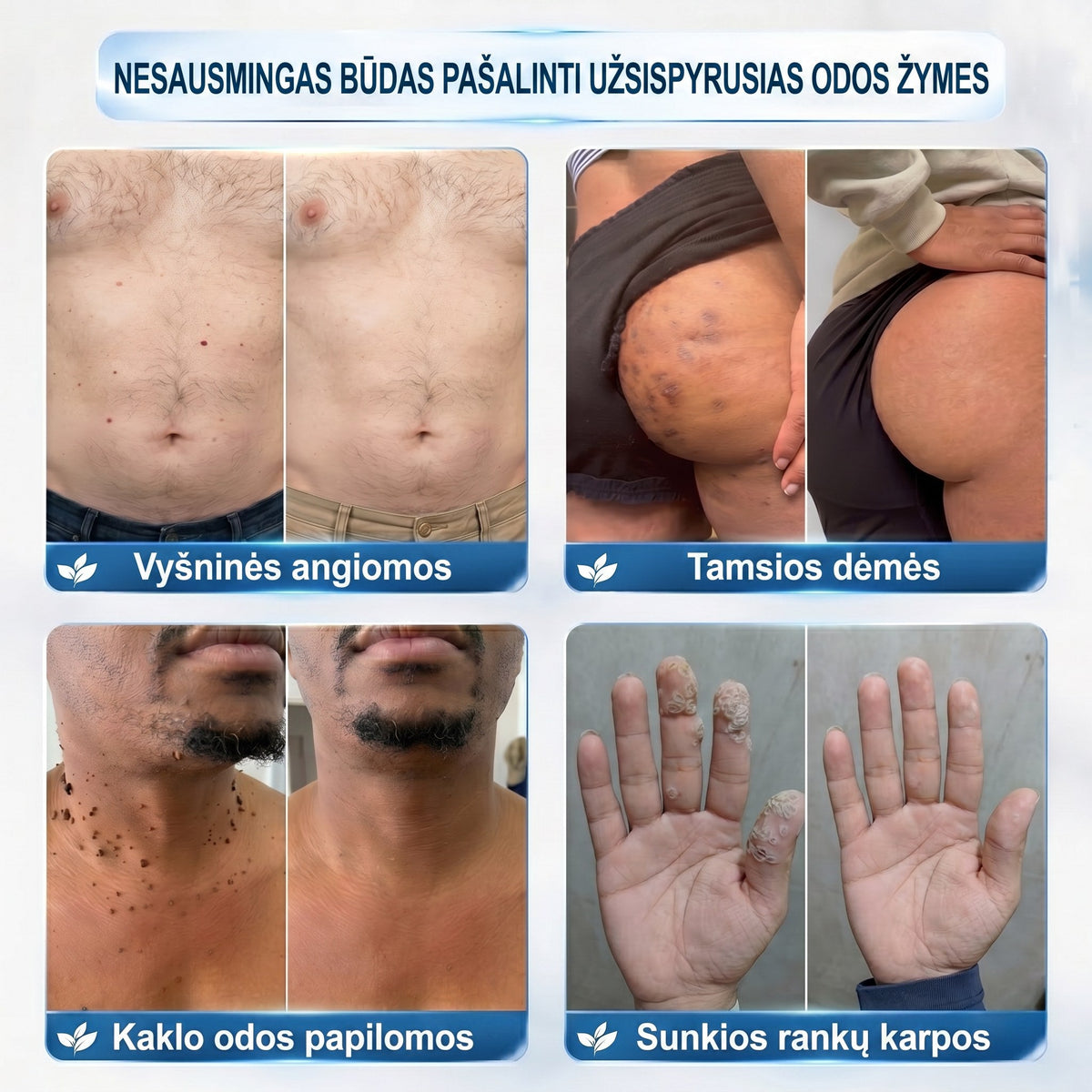 𝐏i𝐜𝐝o® 𝟕 𝐃𝐢𝐞𝐧𝐨𝐬 𝐏𝐢𝐠𝐦𝐞𝐧𝐭𝐢𝐧𝐢ų 𝐃ė𝐦𝐢ų 𝐈𝐫 𝐑𝐚𝐧𝐝ų Š𝐚𝐥𝐢𝐧𝐢𝐦𝐚𝐬 𝐑𝐚š𝐢𝐤𝐥𝐢𝐬✨✨(𝐵𝑒 𝑠𝑘𝑎𝑢𝑠𝑚𝑜, 𝑏𝑒 𝑟𝑎𝑛𝑑ų – 𝑟𝑢𝑡𝑢𝑙𝑖𝑛𝑖𝑠 𝑎𝑝𝑙𝑖𝑘𝑎𝑡𝑜𝑟𝑖𝑢𝑠)