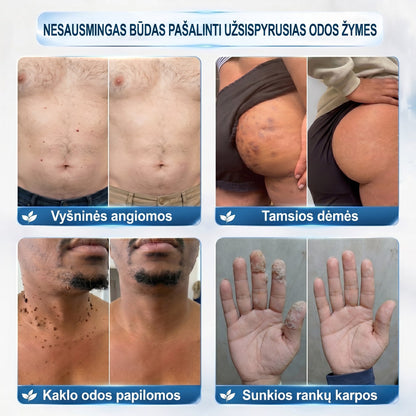 𝐏i𝐜𝐝o® 𝟕 𝐃𝐢𝐞𝐧𝐨𝐬 𝐏𝐢𝐠𝐦𝐞𝐧𝐭𝐢𝐧𝐢ų 𝐃ė𝐦𝐢ų 𝐈𝐫 𝐑𝐚𝐧𝐝ų Š𝐚𝐥𝐢𝐧𝐢𝐦𝐚𝐬 𝐑𝐚š𝐢𝐤𝐥𝐢𝐬✨✨(𝐵𝑒 𝑠𝑘𝑎𝑢𝑠𝑚𝑜, 𝑏𝑒 𝑟𝑎𝑛𝑑ų – 𝑟𝑢𝑡𝑢𝑙𝑖𝑛𝑖𝑠 𝑎𝑝𝑙𝑖𝑘𝑎𝑡𝑜𝑟𝑖𝑢𝑠)