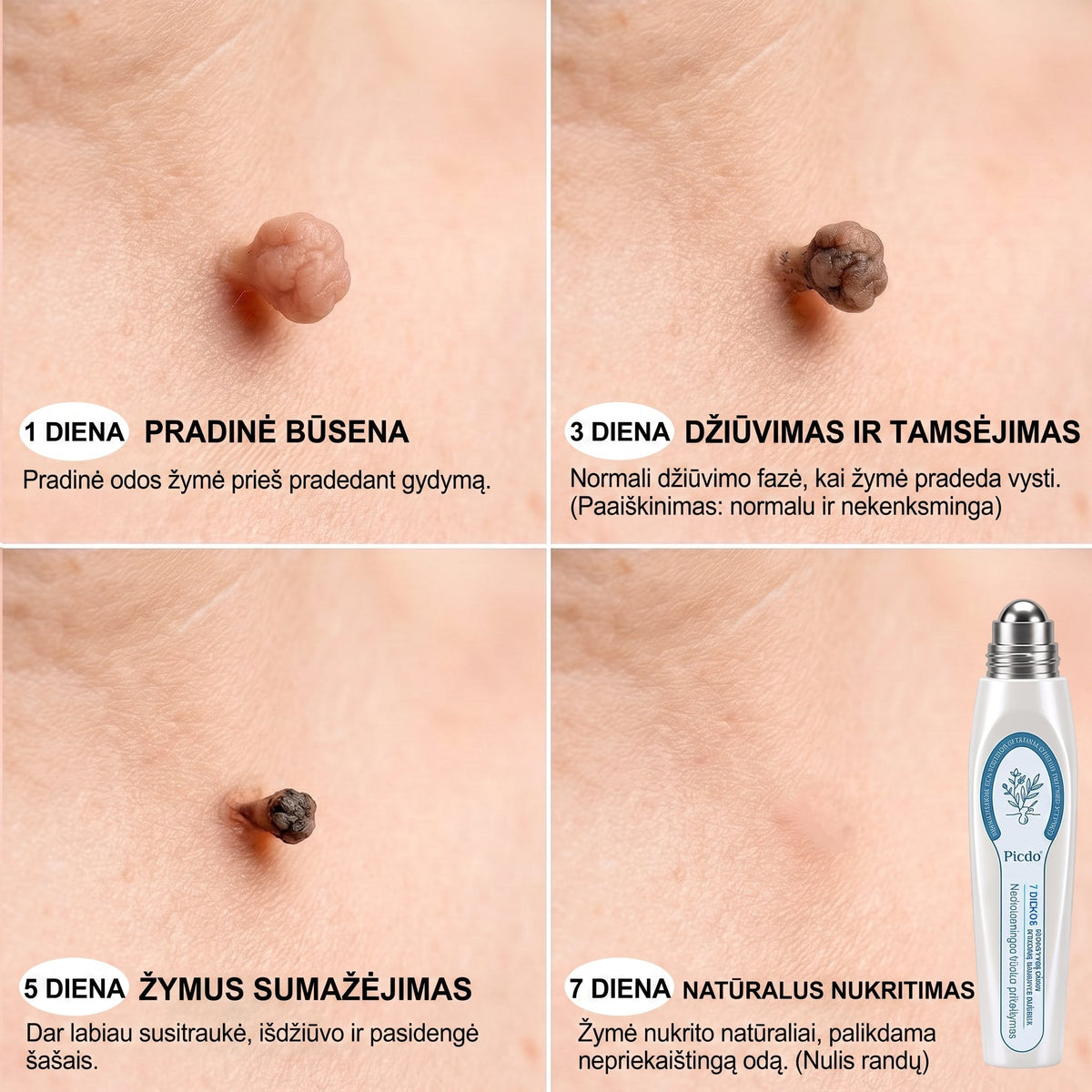 𝐏i𝐜𝐝o® 𝟕 𝐃𝐢𝐞𝐧𝐨𝐬 𝐏𝐢𝐠𝐦𝐞𝐧𝐭𝐢𝐧𝐢ų 𝐃ė𝐦𝐢ų 𝐈𝐫 𝐑𝐚𝐧𝐝ų Š𝐚𝐥𝐢𝐧𝐢𝐦𝐚𝐬 𝐑𝐚š𝐢𝐤𝐥𝐢𝐬✨✨(𝐵𝑒 𝑠𝑘𝑎𝑢𝑠𝑚𝑜, 𝑏𝑒 𝑟𝑎𝑛𝑑ų – 𝑟𝑢𝑡𝑢𝑙𝑖𝑛𝑖𝑠 𝑎𝑝𝑙𝑖𝑘𝑎𝑡𝑜𝑟𝑖𝑢𝑠)